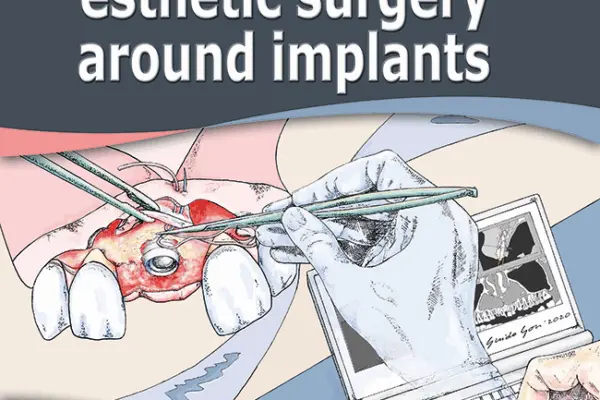 Giovanni Zucchelli: Innovatore nell’Odontoiatria Estetica