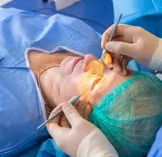 Interventi di Cataratta a Catania: Tutto quello che Devi Sapere