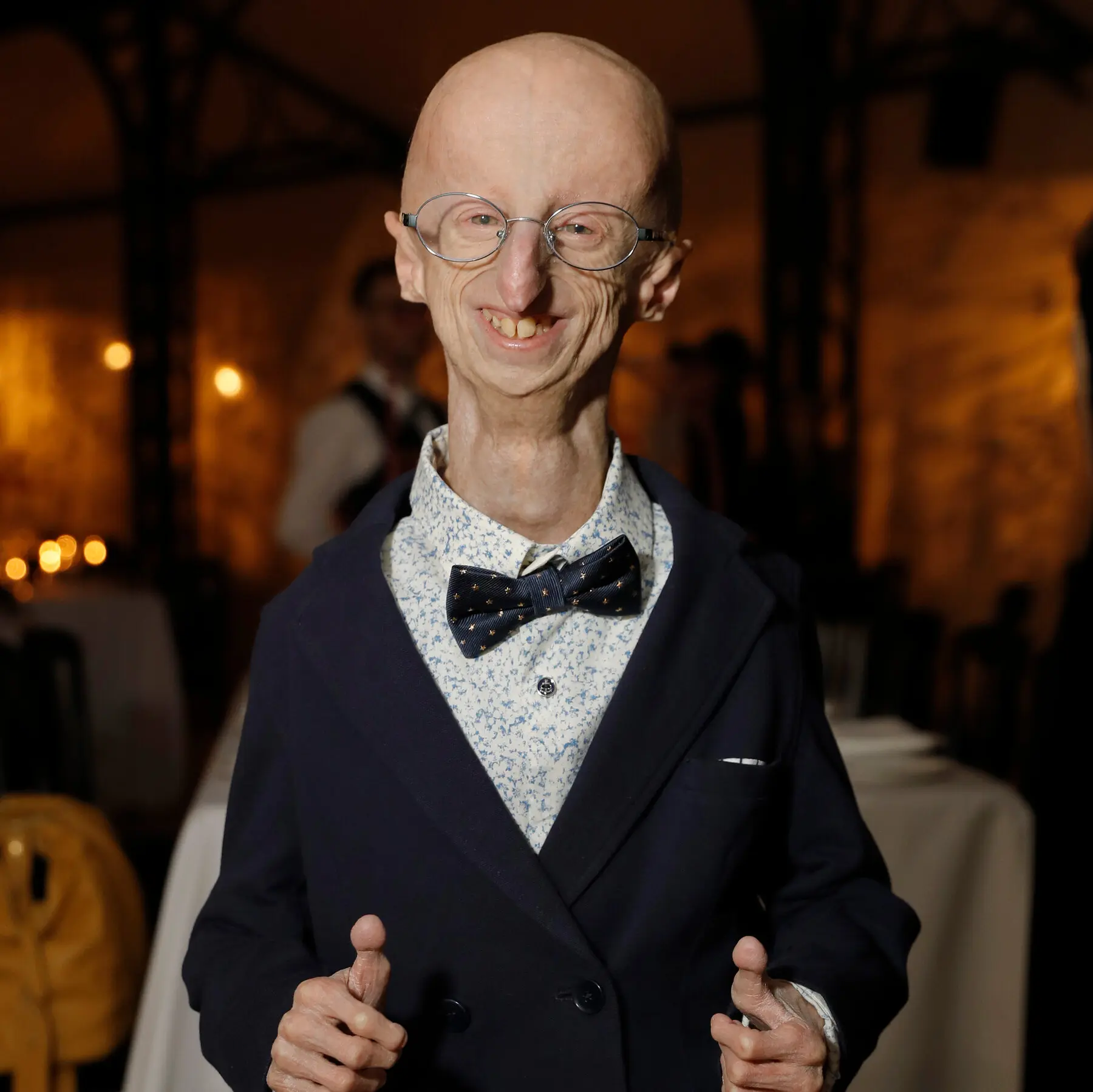 La Storia Ispiratrice di Sammy Basso