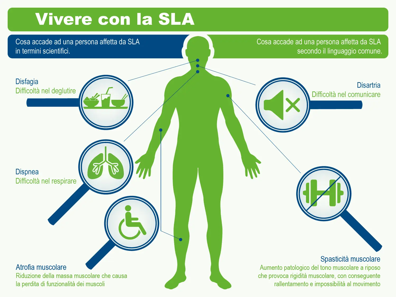 SLA Malattia: La Sclerosi Laterale Amiotrofica in Focus