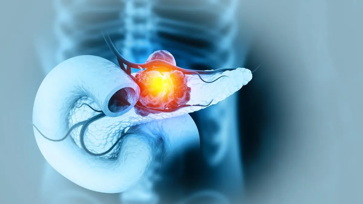 Pancreas: Quali sono i progressi nella ricerca sul ?